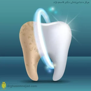 عکس شاخص سفید کردن دندان
