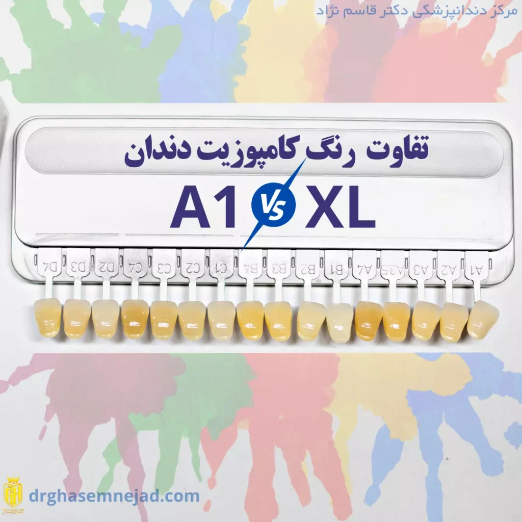 رنگ کامپوزیت دندان A1 و XL