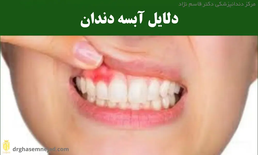 دلایل آبسه دندان