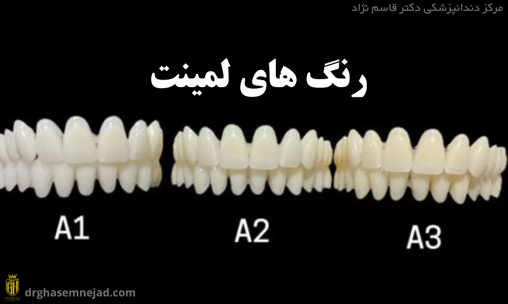 رنگ A3 و B1 کامپوزیت و لمینت دندان