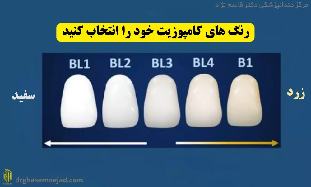 انتخاب رنگ کامپوزیت دندان
