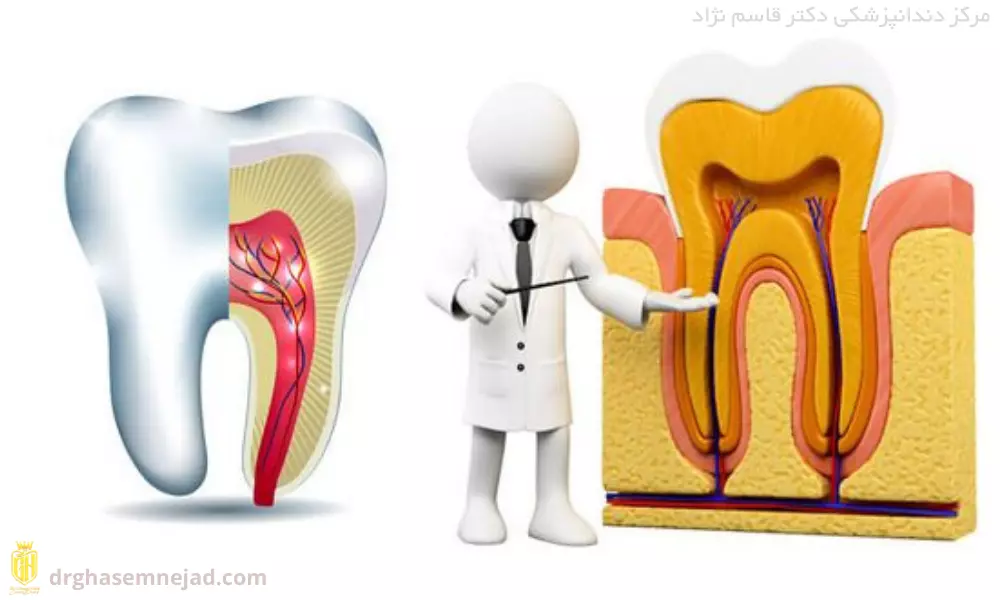 عصب کشی دندان زعفرانیه