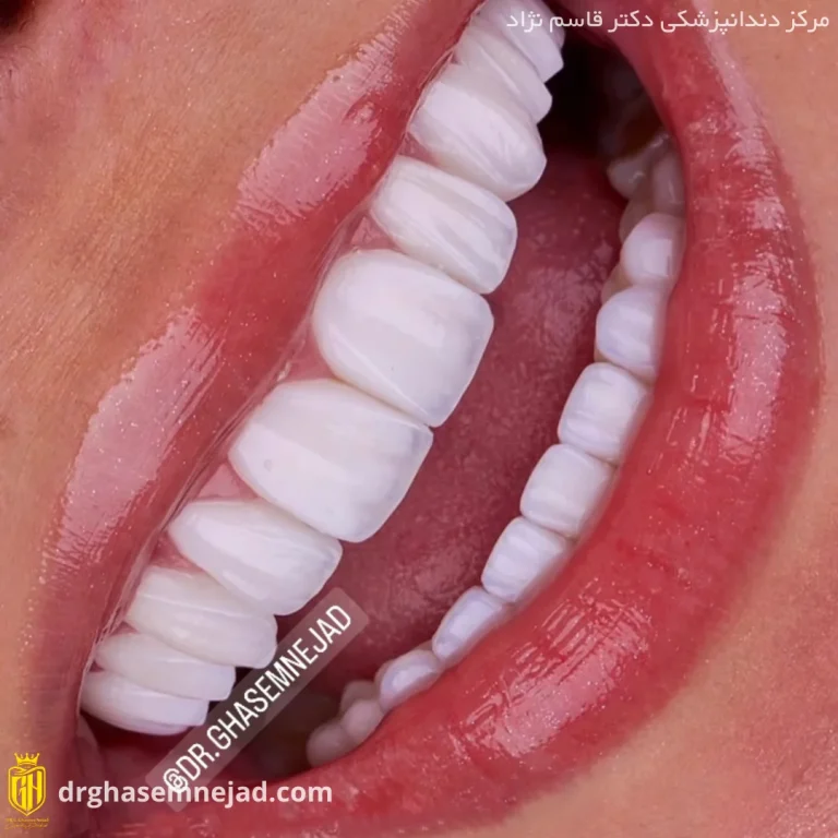 -دندان-26-768x768.webp