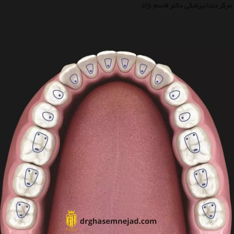 اسکن 3‌ بعدی دندان