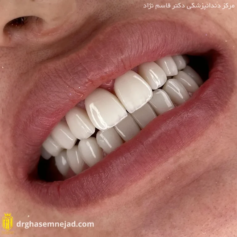  دندان (10)