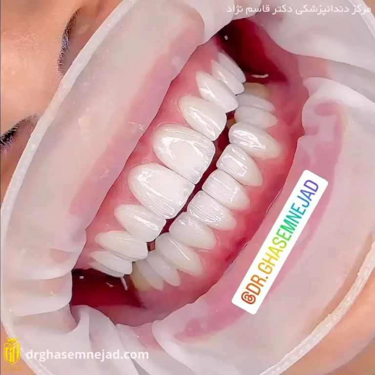  دندان (24)