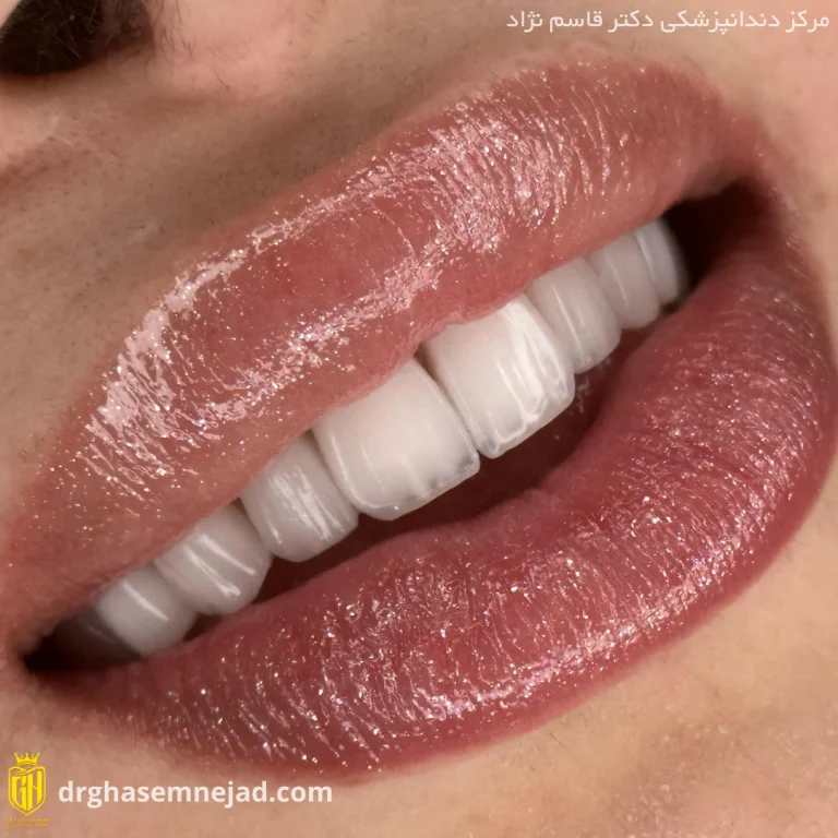  دندان (5)