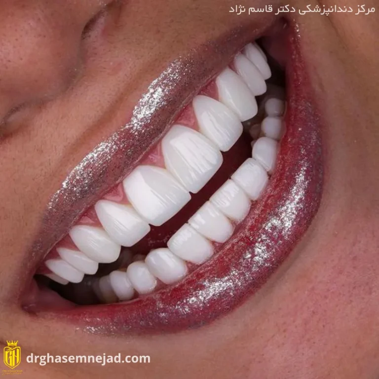  دندان (6)