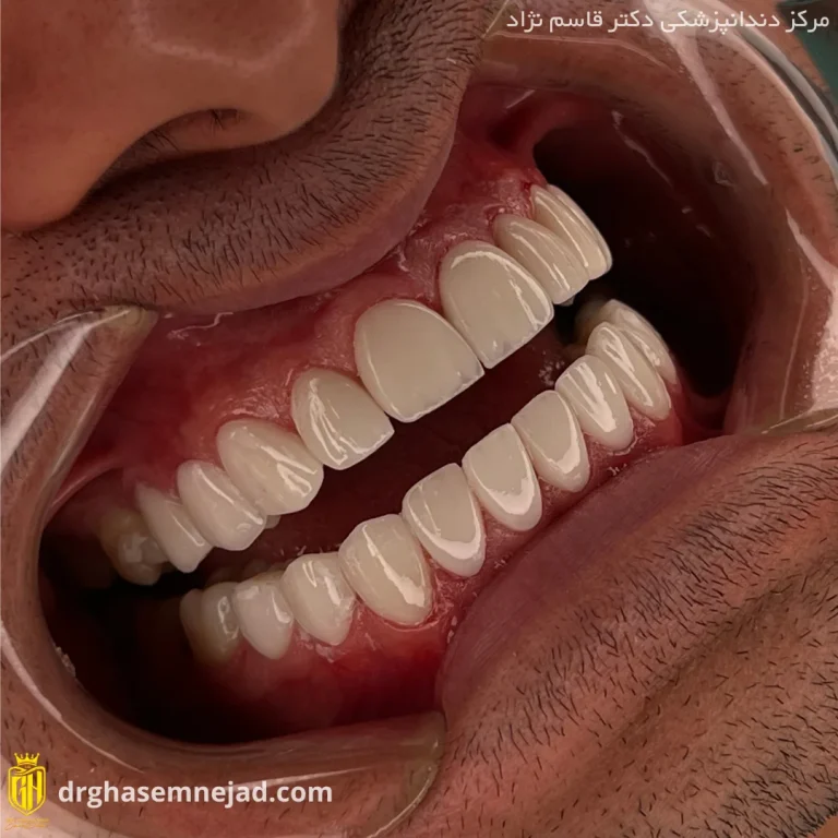  دندان (7)