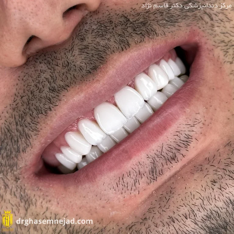  دندان (8)