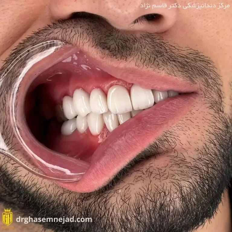  دندان (9)