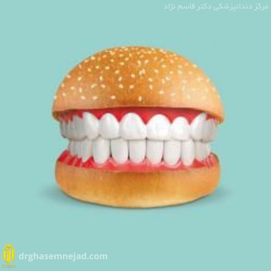 کامپوزیت-پوسیده-دندان