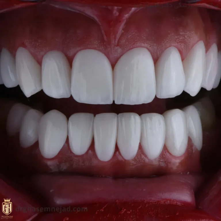  دندان 1403 (3)