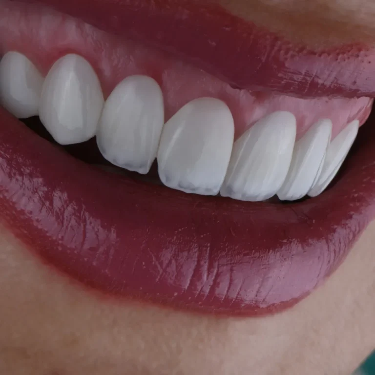  دندان 1403 (9)