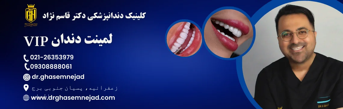 لمینت دندان وی آی پی Vip