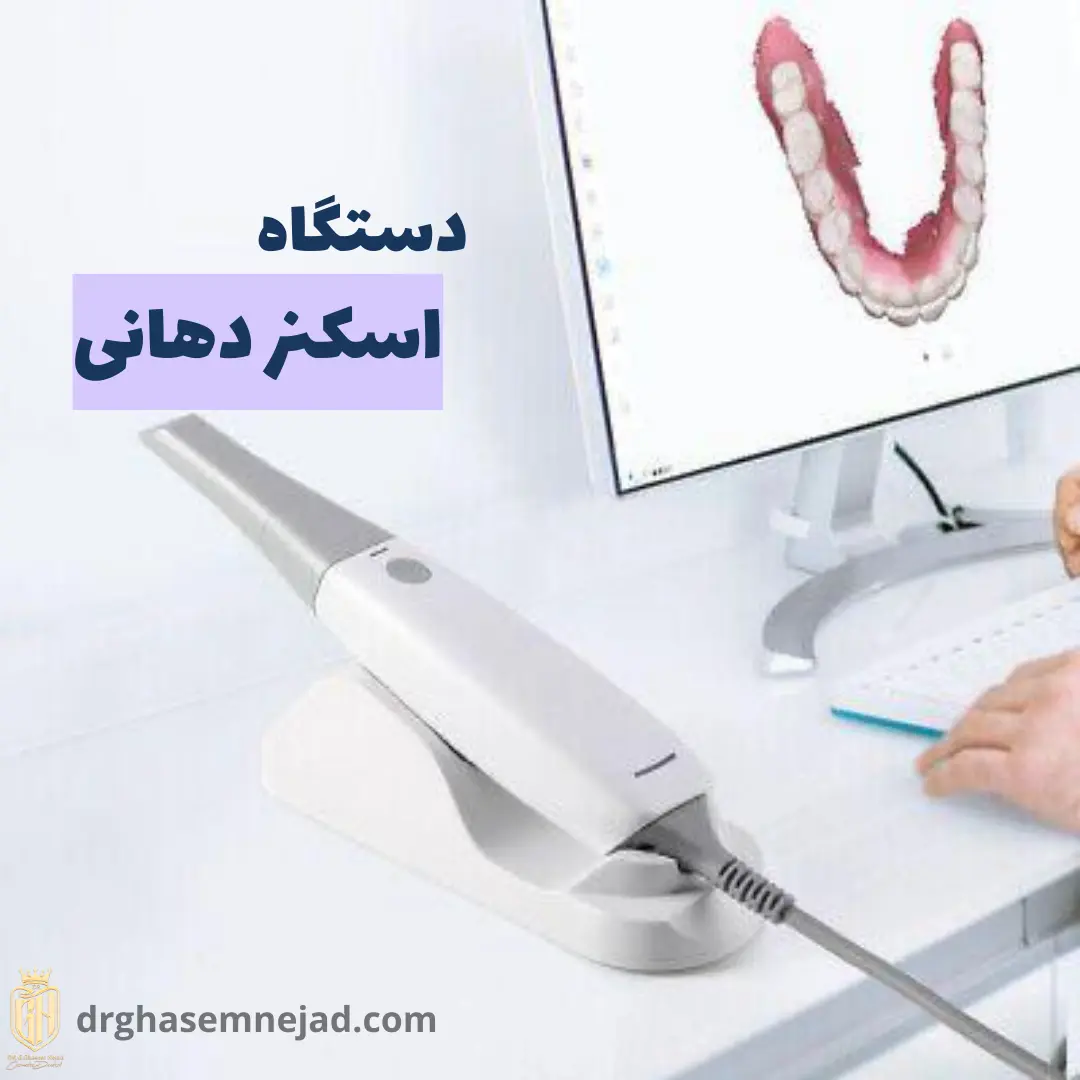 اسکنر دهانی دندان